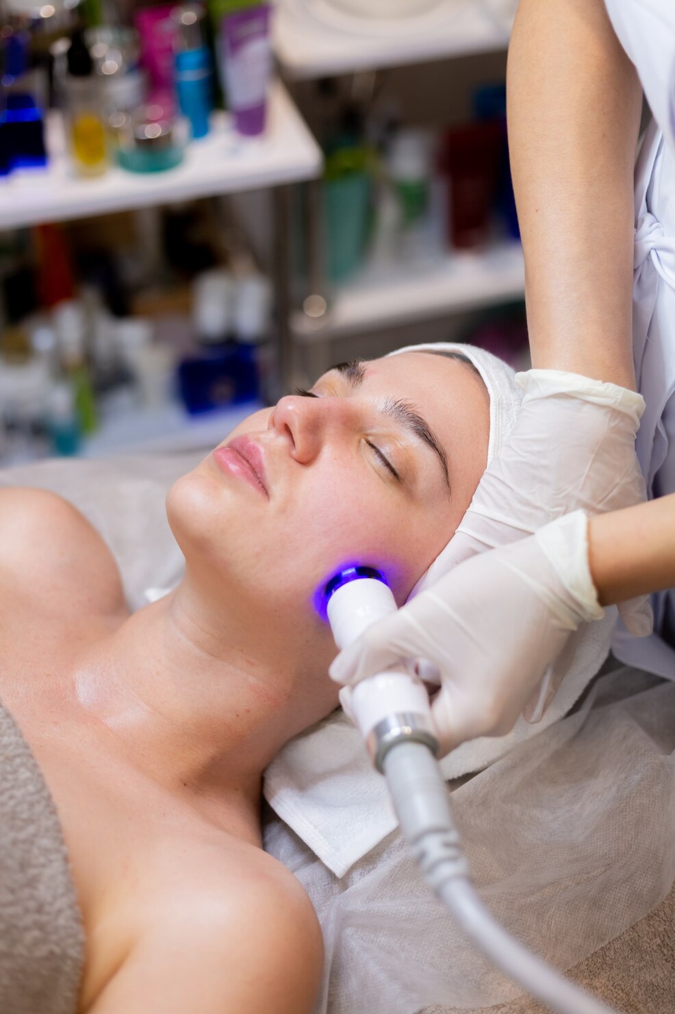 IPL facial